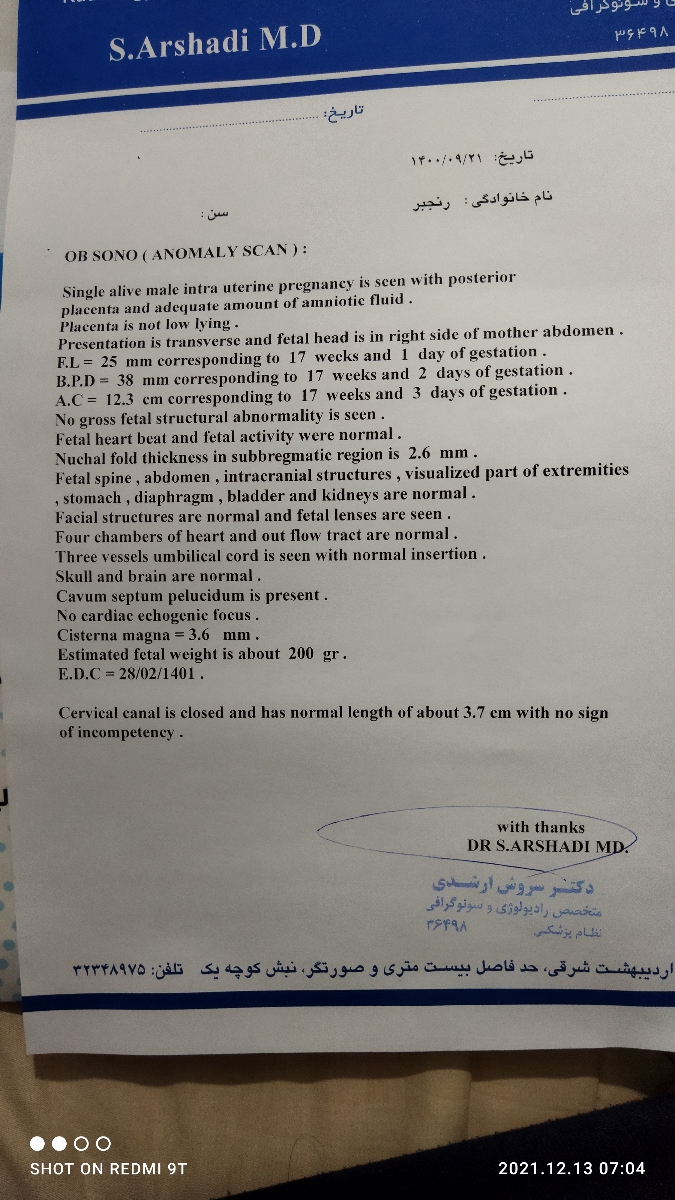 دکتر عزیز تفسیر سونو آنومالی ممنون میشم