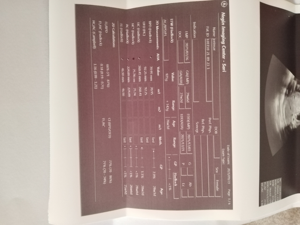 سونو هفته ی سی ام وزن کم جنین