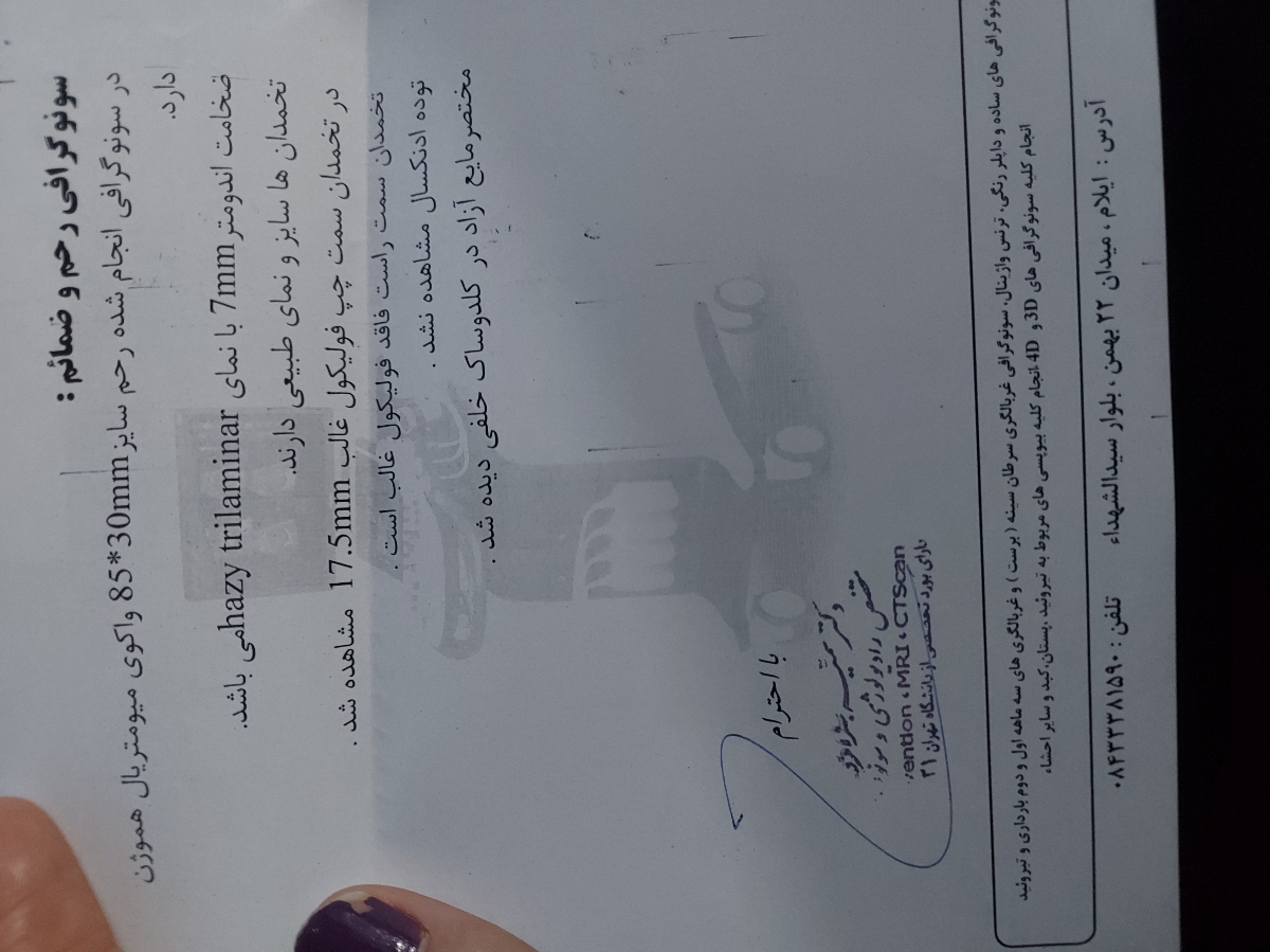 سونو فولیکول در ۱۲ سیکل