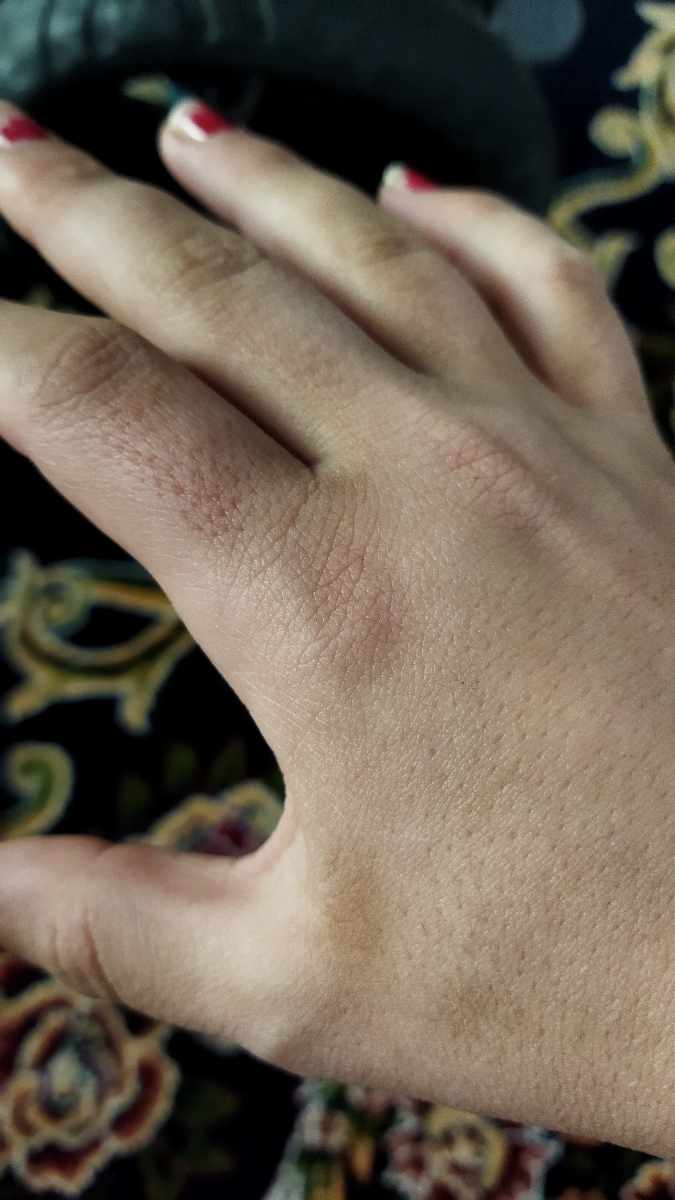 دکترجان این لکه روی صورت پسرم چیه؟