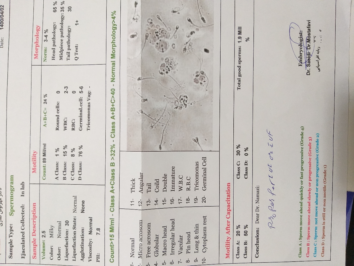 عکس رنگی و پولیپ اندومتریال و سونو واژینال