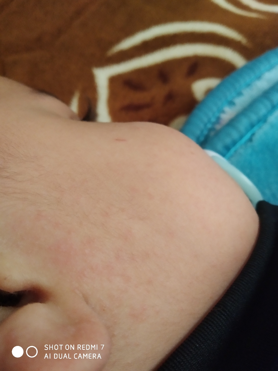 سلام خانم دکتر لطفاً صورت نوزادم رو ببینید