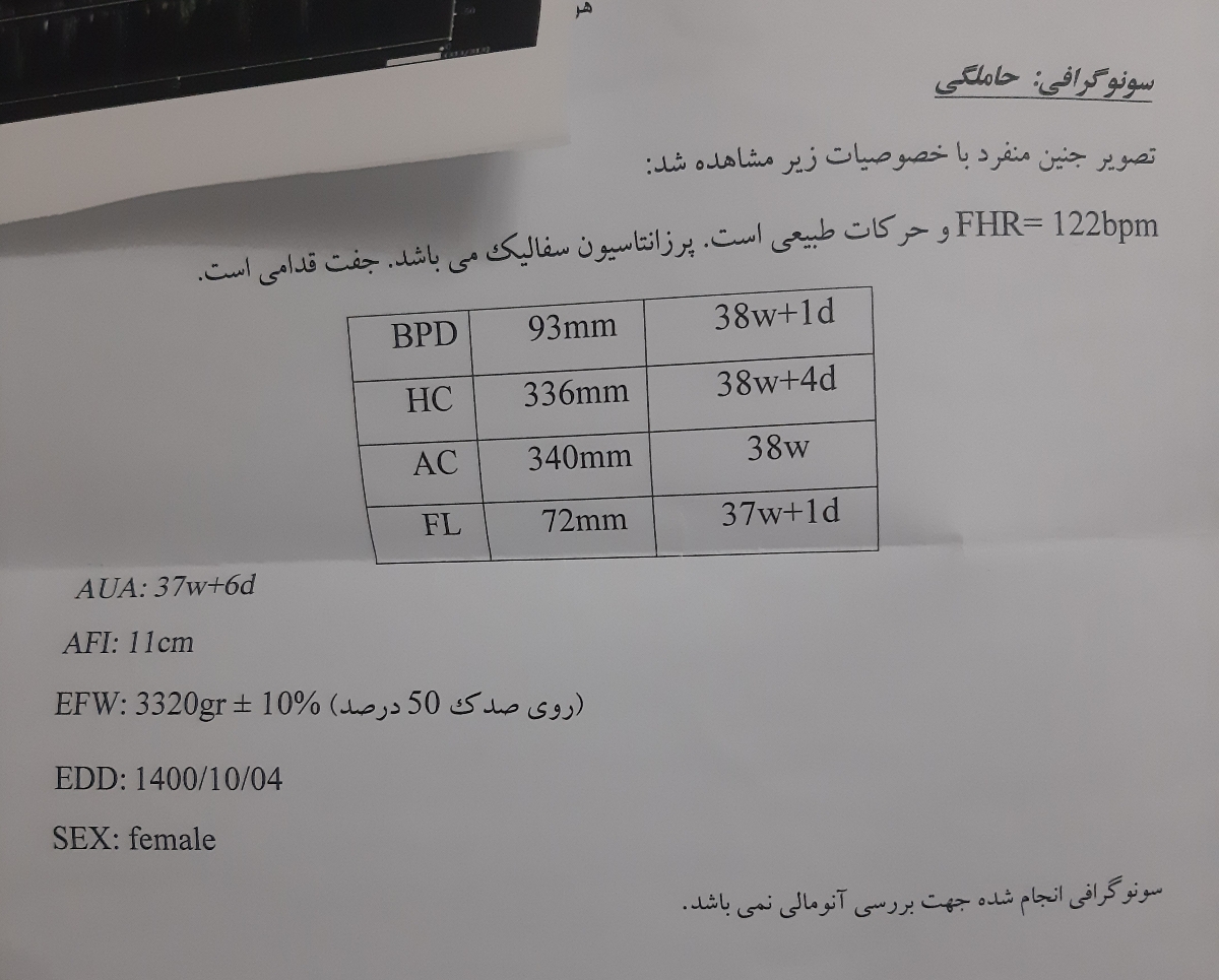 تفاوت در سونوی ماهای اخر