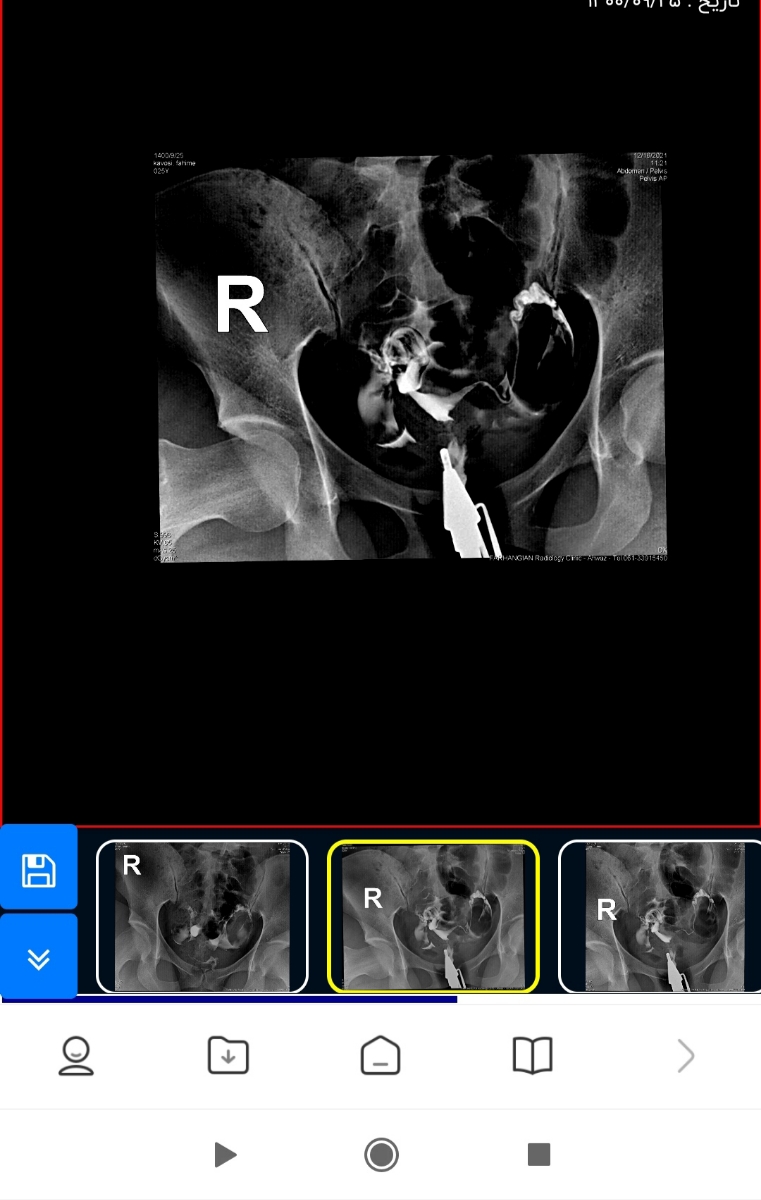 پزشک اوما لطفا تفسیر سونو رنگی منو ببینید