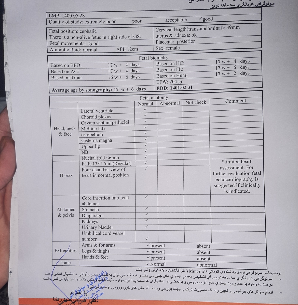 سونو آنومالی منو میبیند