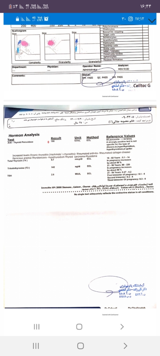 تفسیر ازمایش تیروئید در بارداری