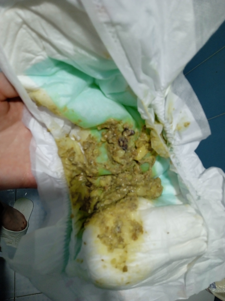 گریه کودک هنگام پی پی کردن