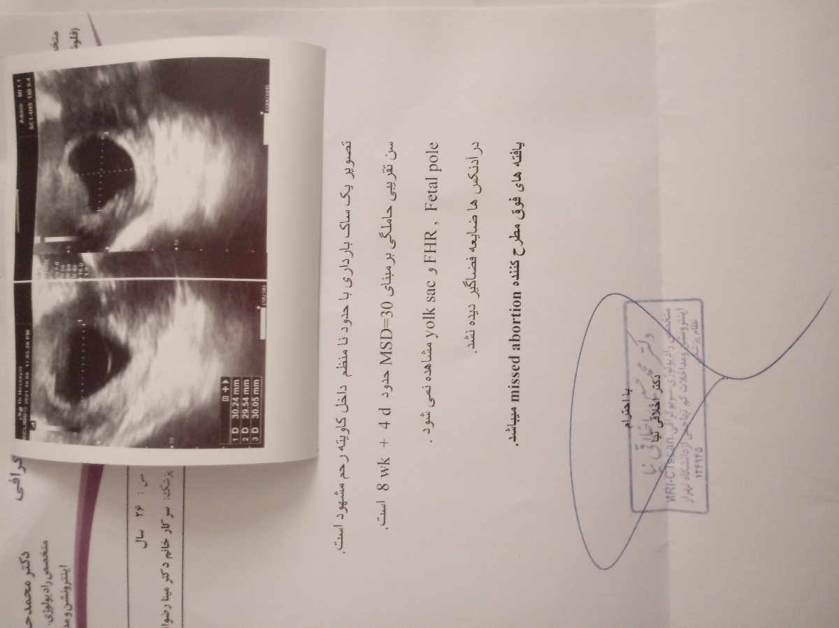 سونوگرافی هفته 12 بارداری سونوگرافی هفته 12 بارداری