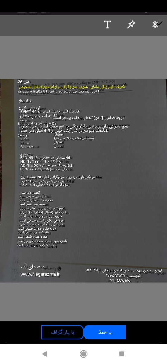 تفسیر سنوگرافی آنومالی