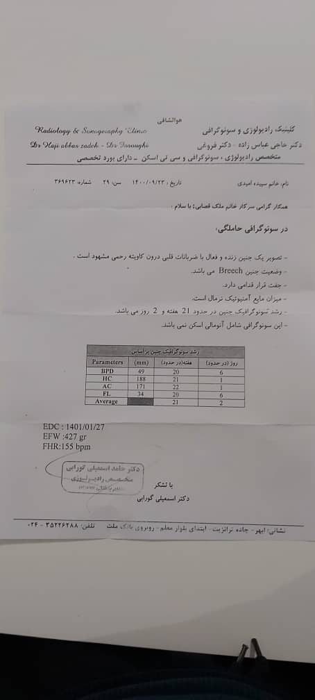 کمبود وزن در بارداری