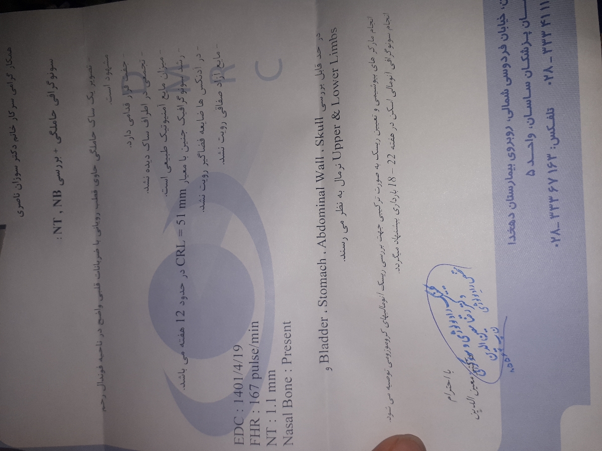 تعیین جنسیت با سونو ان تی تعیین جنسیت با سونو ان تی