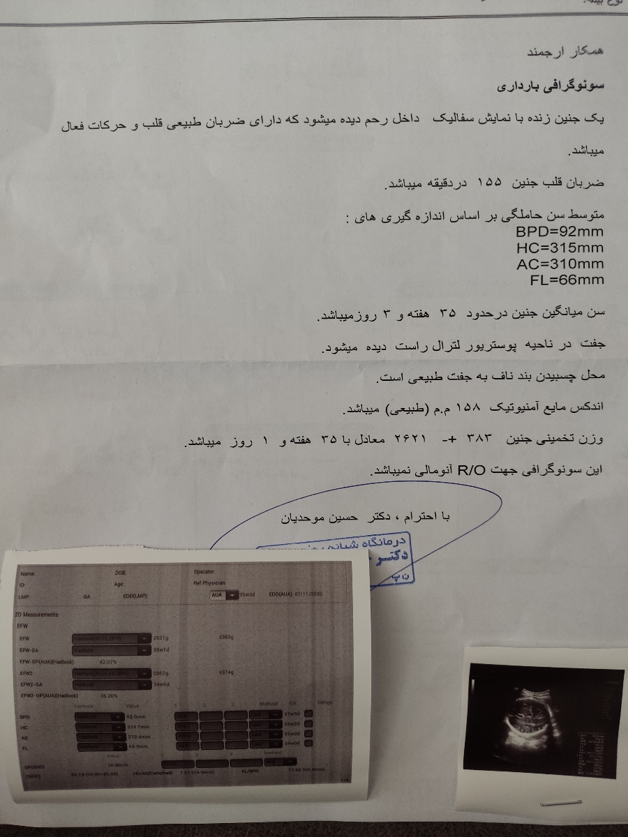 تفسیر سونوگرافی هفته سی و هفته سی و پنج