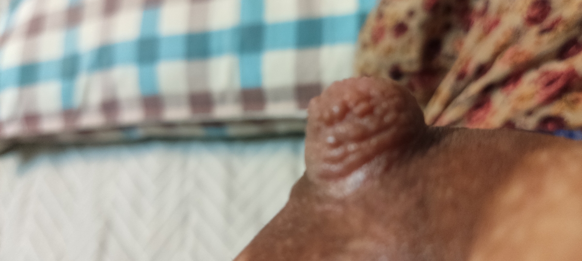 سوزش سر سینه و درد سوزش سر سینه و درد
