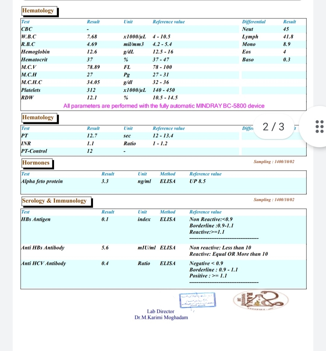 تفسسیر ازمایش لطفا