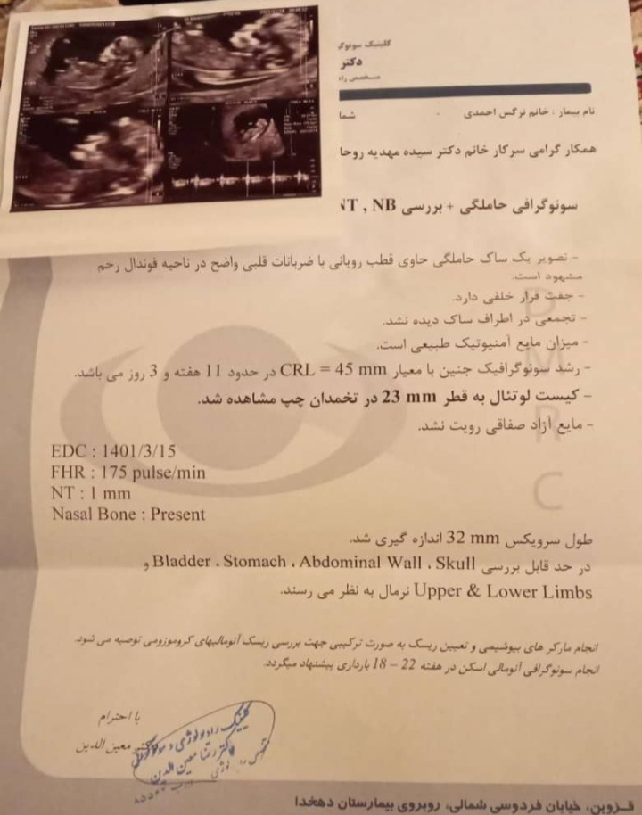 جفت قرار خلفی دارد