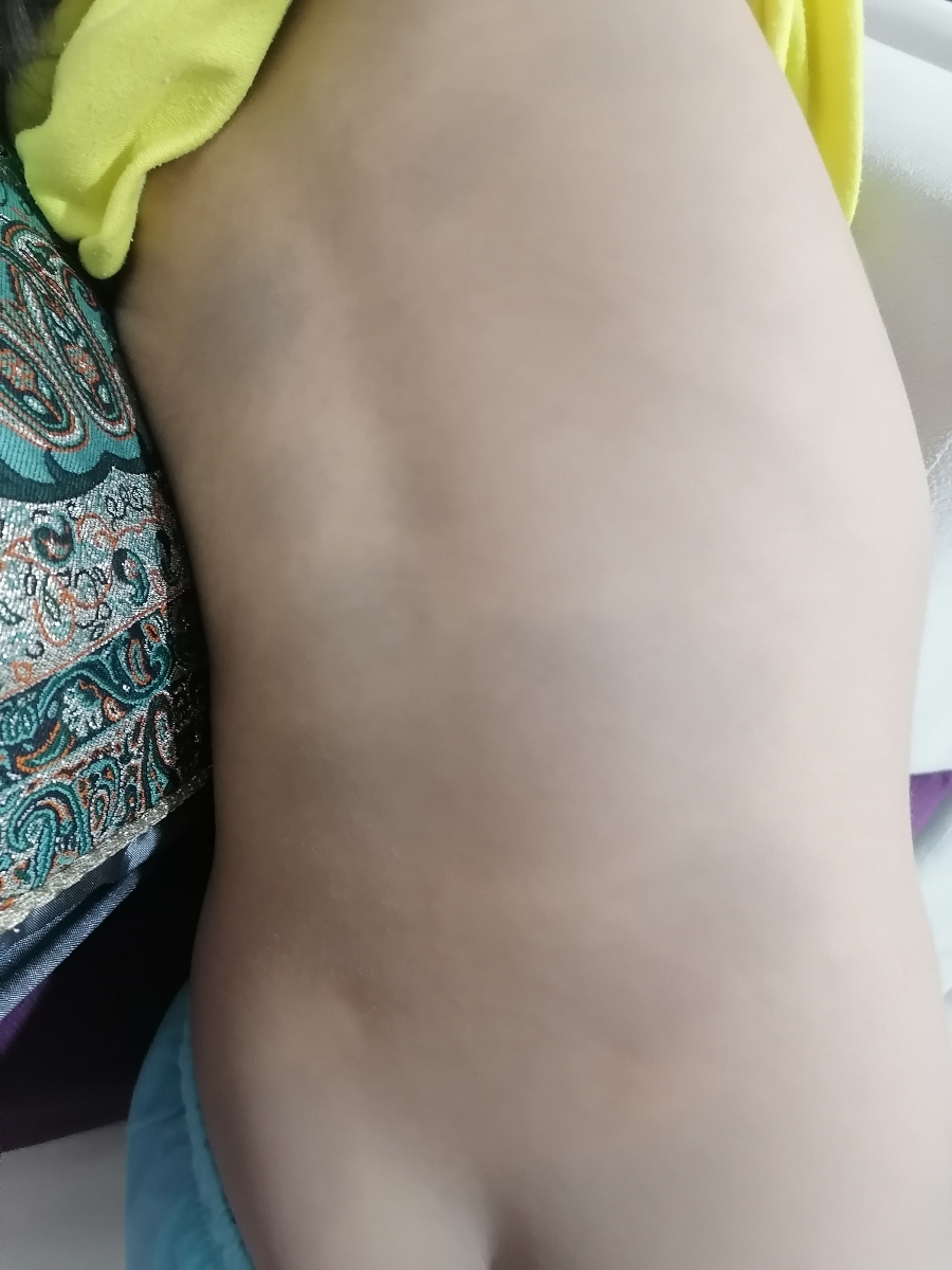 بخاطر اون لک ناراحتی؟ من کل پست و باسن گسرم این لک و داره همیشه هم بوسش میکنم و قربونش میرم دکترم گفت این لک تا 7 سالگی میره بخاطر اون لک ناراحتی؟ من کل پست و باسن گسرم این لک و داره همیشه هم بوسش میکنم و قربونش میرم دکترم گفت این لک تا 7 سالگی میره