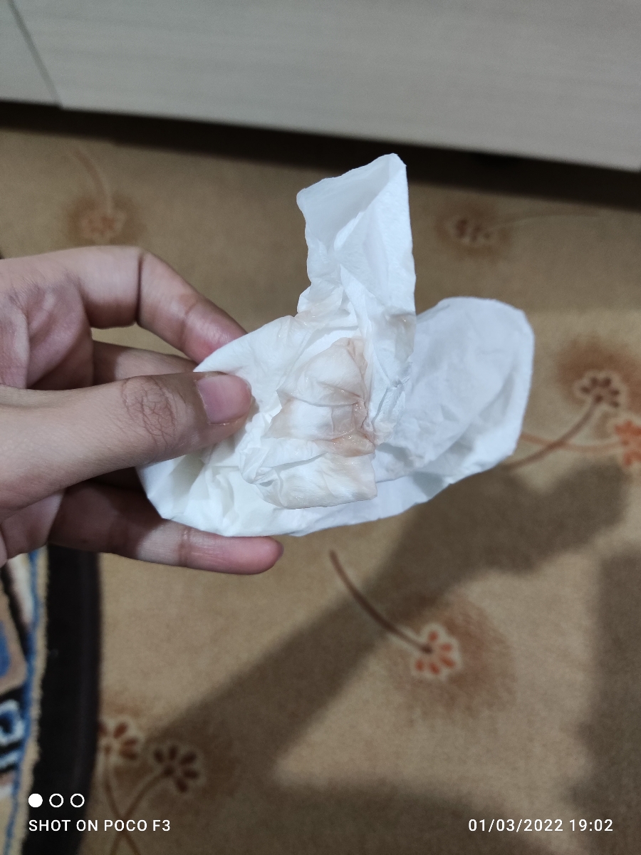 دکتر ترشحاتم اینجوری شده توروخدا زودتر بگین چیکار کنم 😭😭😭😭