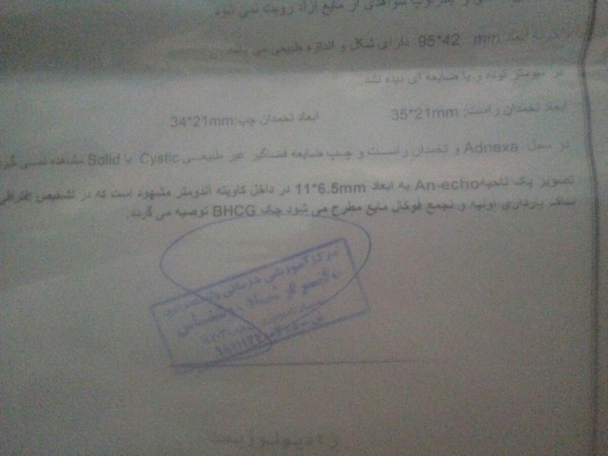 تشخیص بارداری و تشریح آزمایش تشخیص بارداری و تشریح آزمایش