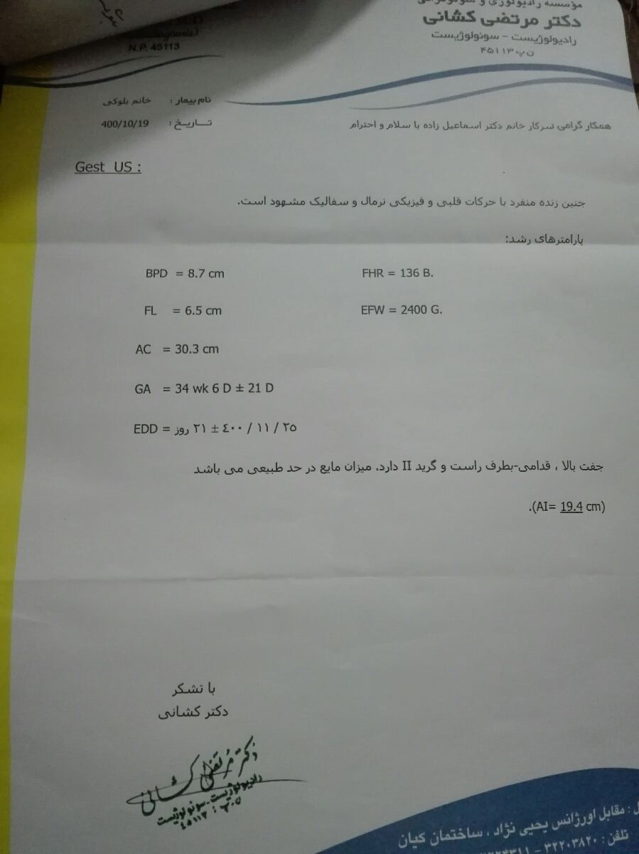 تفسیر سونو 33هفته و 2روز