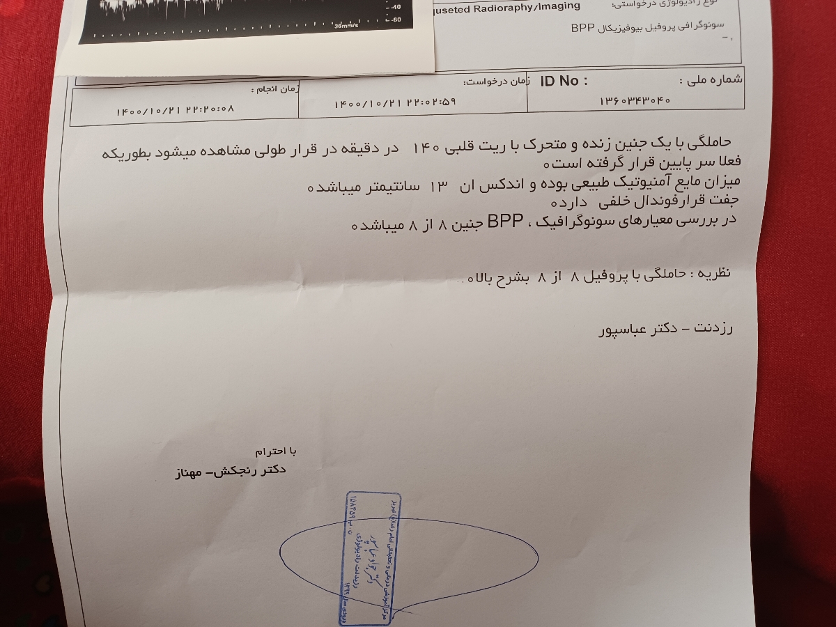 نوار قلب جنین و ضربان قلب نا منظم نوار قلب جنین و ضربان قلب نا منظم