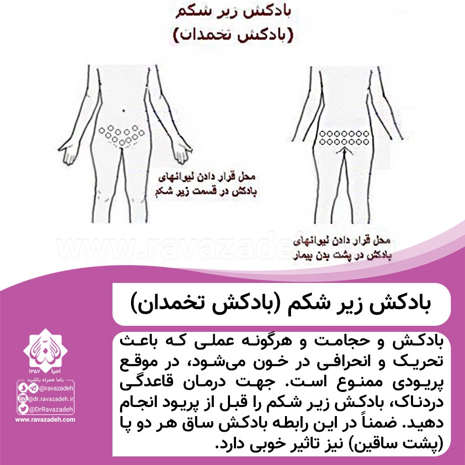 سلام دوستان میخام بادکش رحم انجام بدم میشه کمک کنید!! سلام دوستان میخام بادکش رحم انجام بدم میشه کمک کنید!!