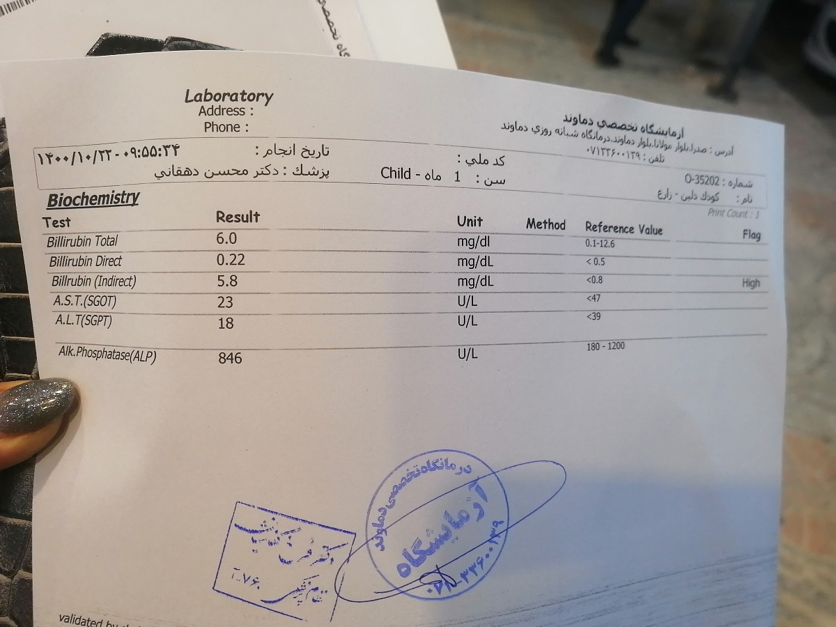 ازمایش انزیم کبد نوزاد ۳۵ روزه لطفااا ببینید