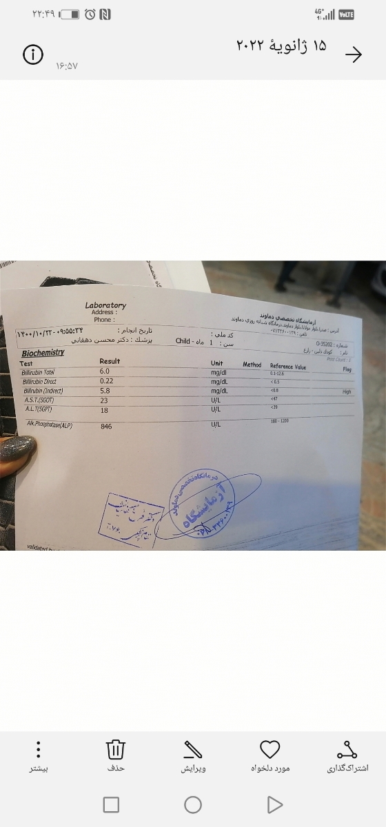 دکتر اوما عزیز این ازمایش تفسیر میکنید