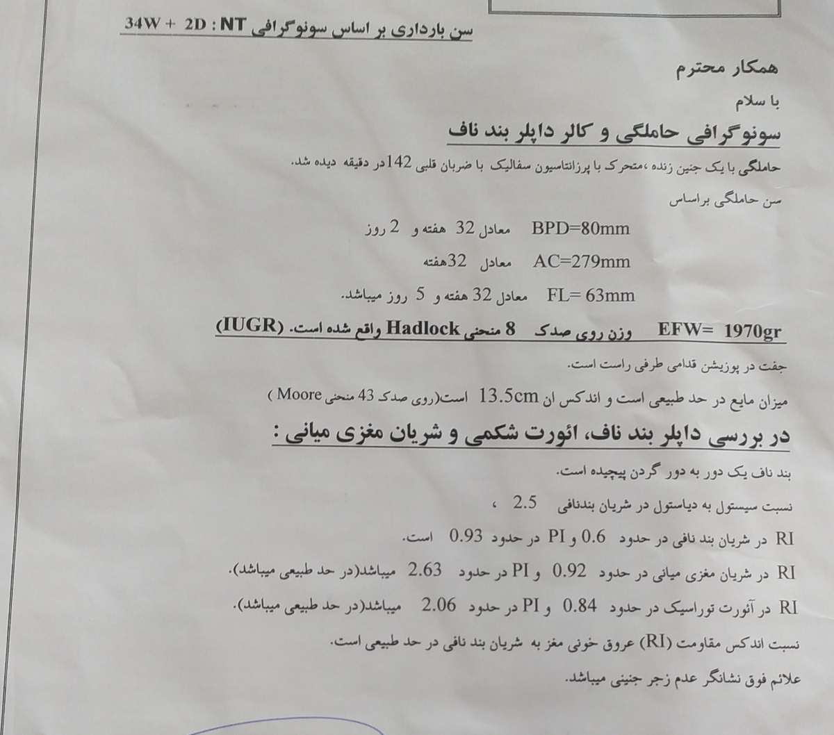 پیچیدن بند ناف دور‌گردن جنین