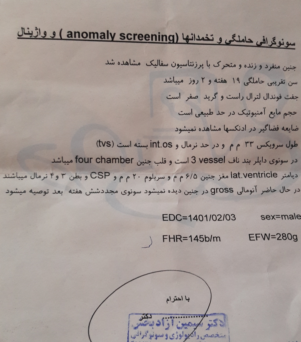 دیامتر مغز و سر بلوم