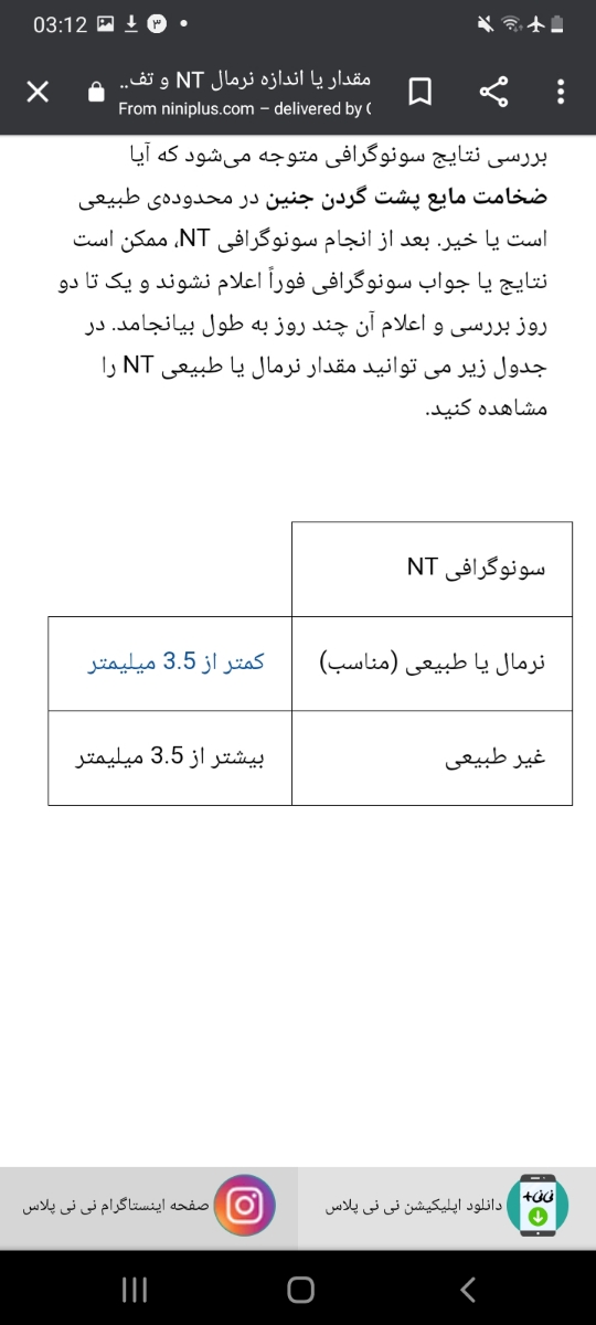 سنو ان تی دادم استرس گرفتم