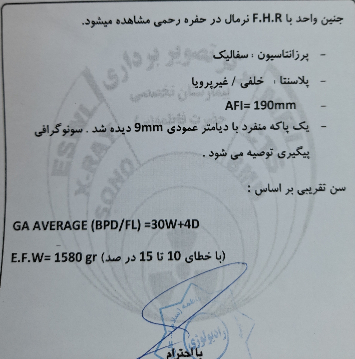 سونوگرافی وزن جنین ۳۰ هفته