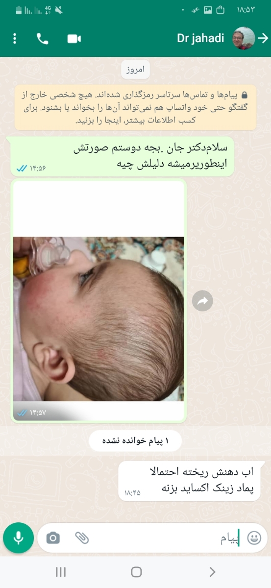 اگزما یا حساسیت پوست صورت