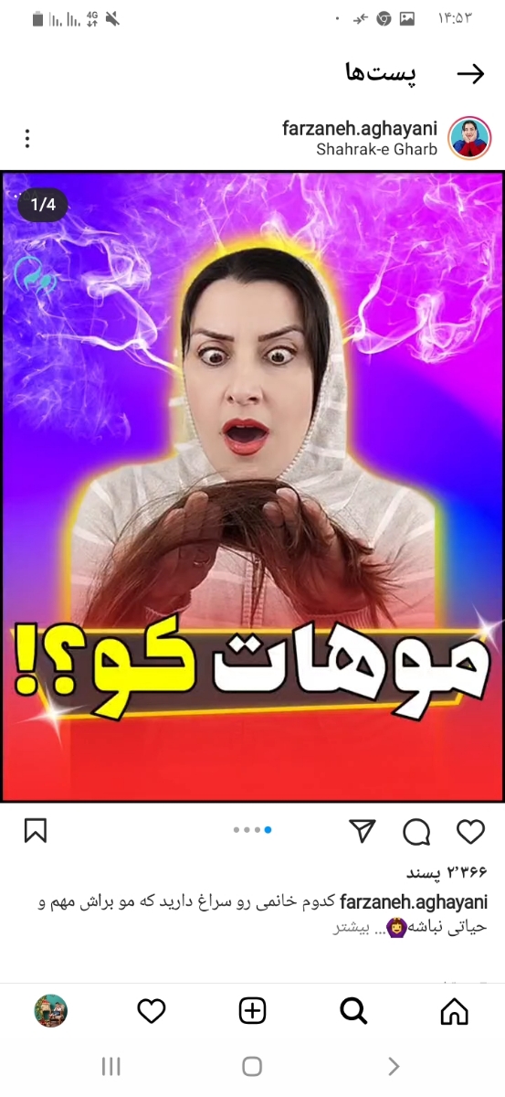 ریزش شدید مو و نداشتن چاره؟