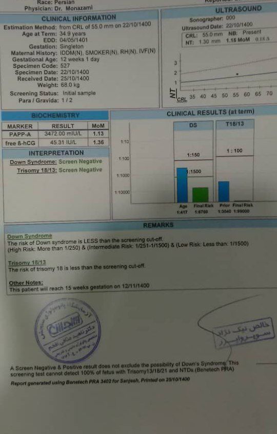غربالگری اول و ریسک سندروم داون بخاطر سن