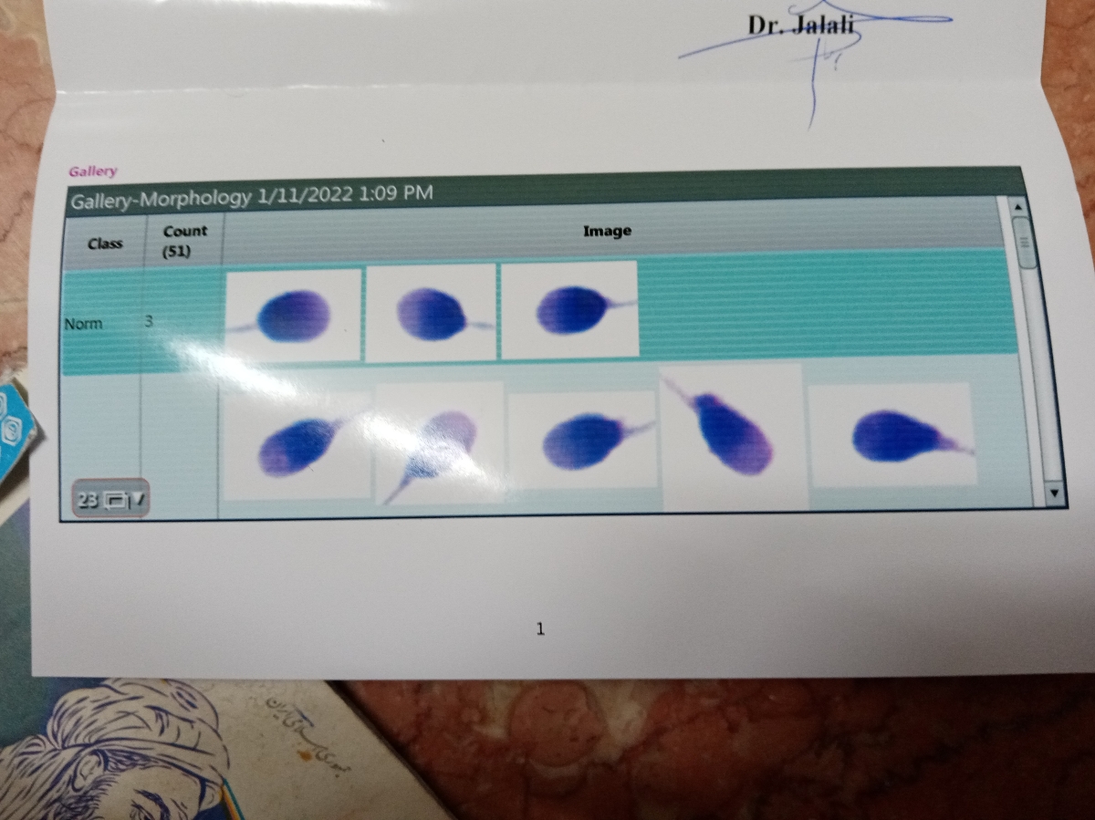 آزمایش sperm DNA fragmention همسرم...