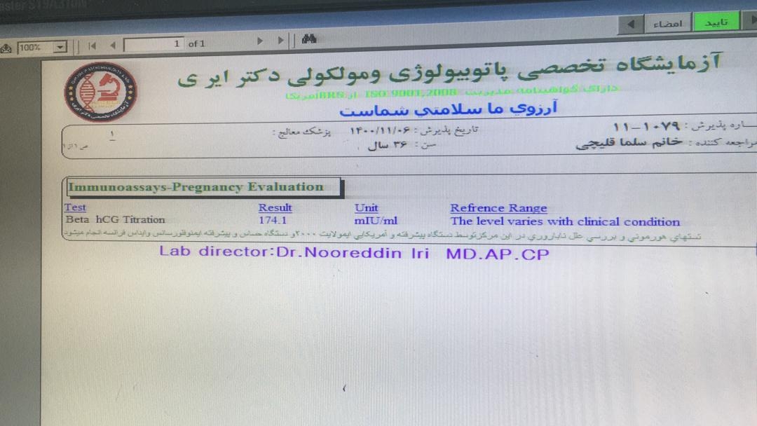 بی بی چک و تست بتا رو ببینید بی بی چک و تست بتا رو ببینید