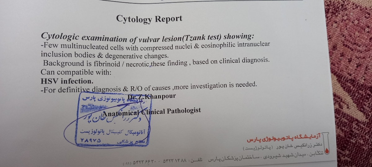 تفسیر ازمایش تبخال