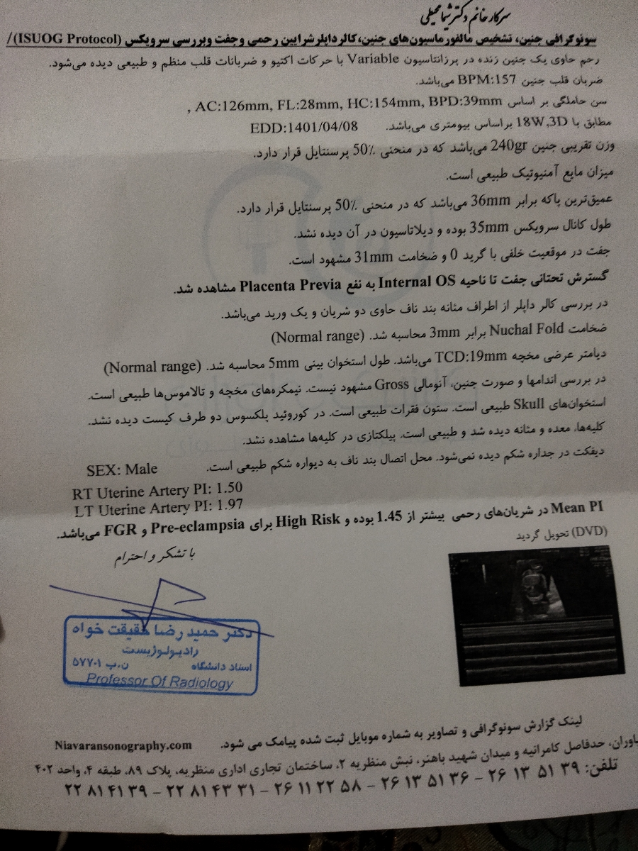 بررسی سونوگرافی انومالی و قلب جنین