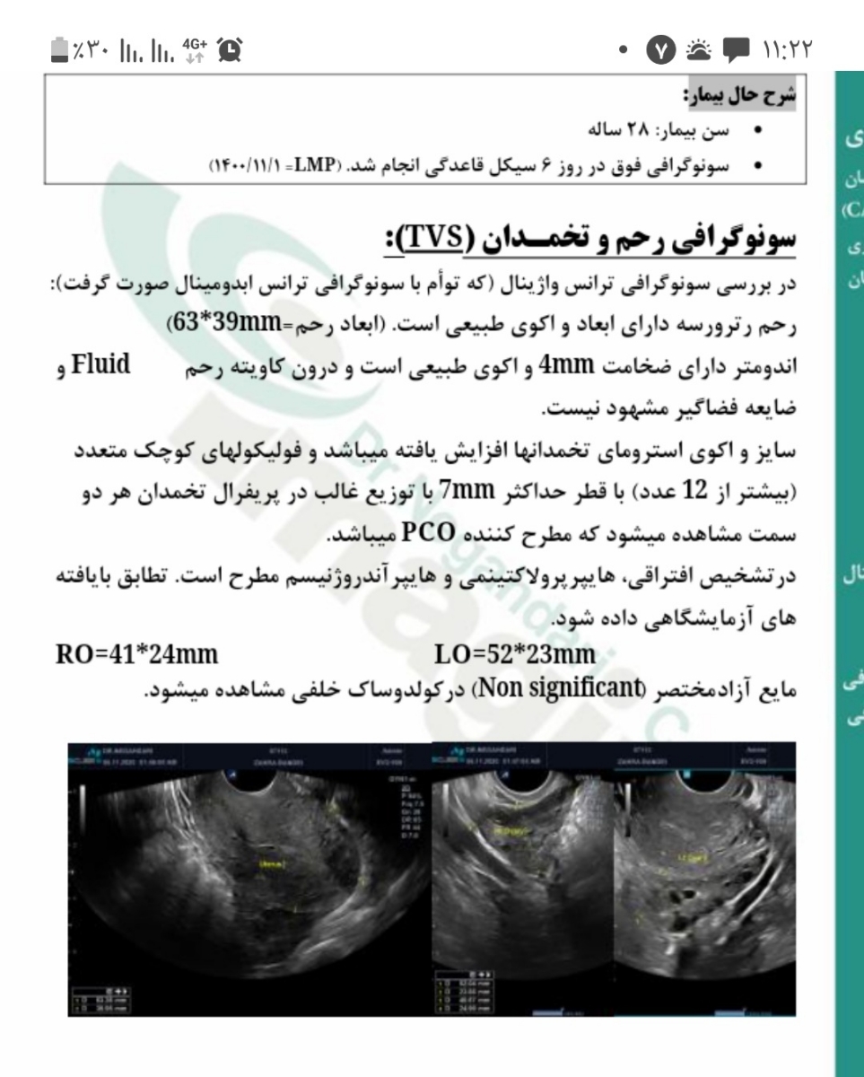 این سونو واژینالی ک تشخیص pco دادن من پریودم ۳۵ روزه و تخمک گذاری ۲۰ پری 