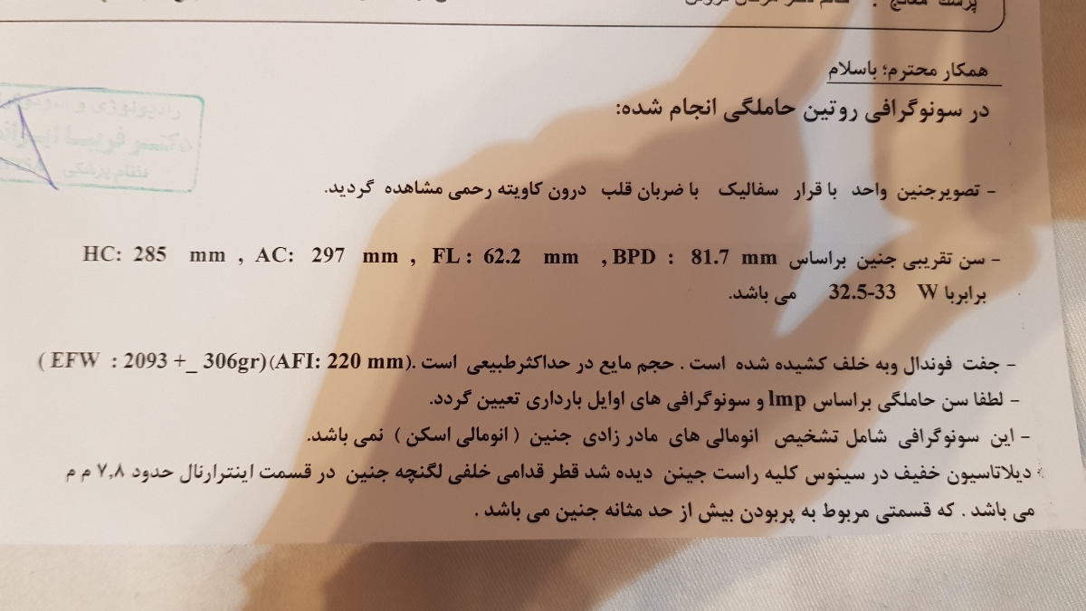 پر بودن مثانه جنین و اب زیاد دور جنین