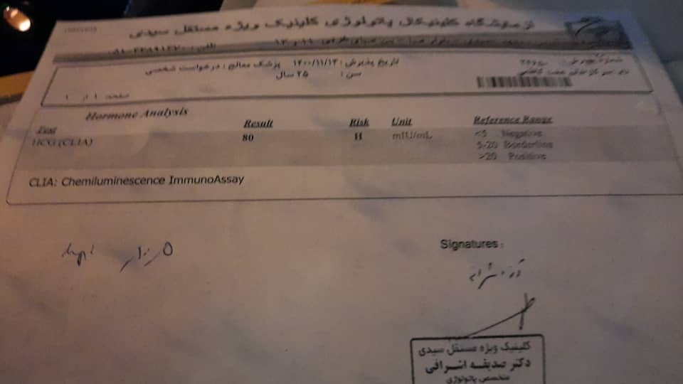 این آزمایش اوله