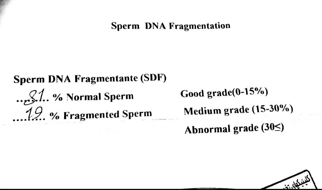 تفسیر آزمایش اسپرم و DNA