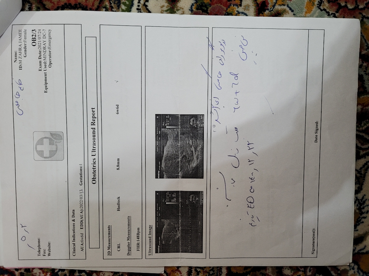 این اولین سونو این اولین سونو