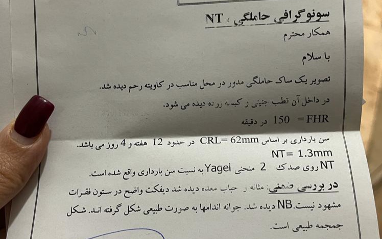 واسه منم نوشته روی صدک ۲ منحنی Yagel