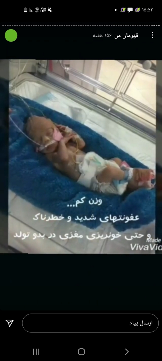 زایمان طبیعی راحتتر زایمان طبیعی راحتتر