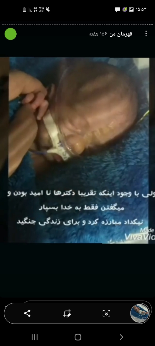 زایمان طبیعی راحتتر زایمان طبیعی راحتتر