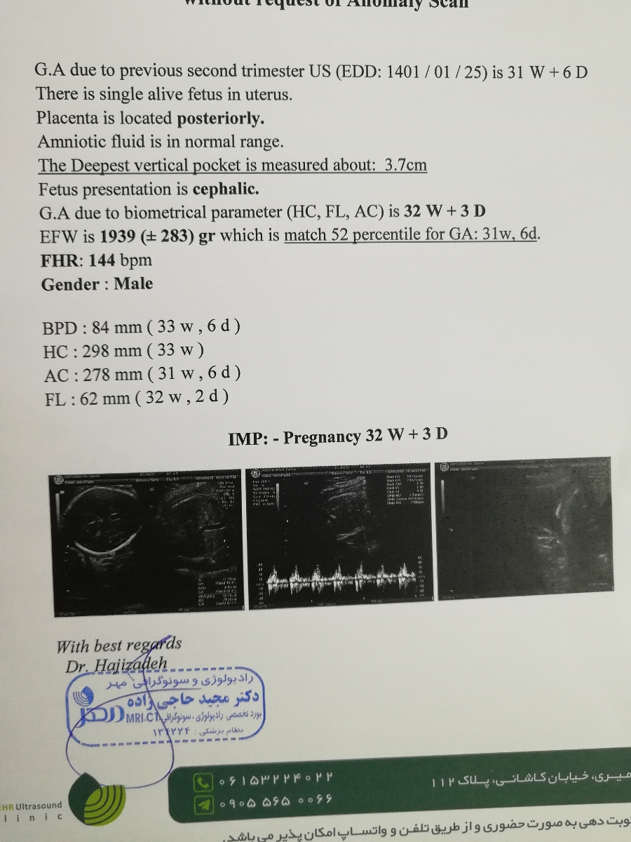 تفسیر سونوگرافی تعیین وزن جنین هفته 32
