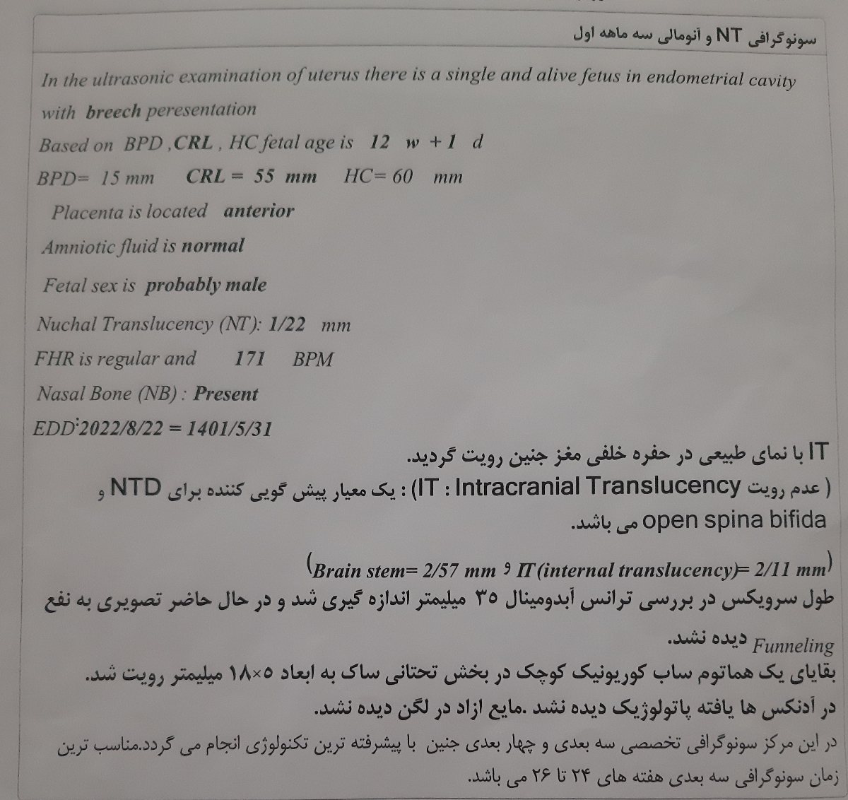 ارگاسم رسیدن در خواب ارگاسم رسیدن در خواب