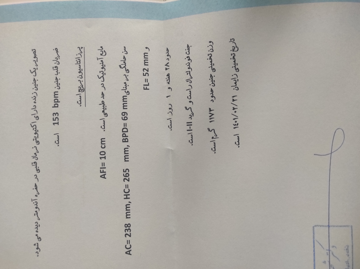 تفسیر سونوگرافی هفته ۲۸ بارداری تفسیر سونوگرافی هفته ۲۸ بارداری