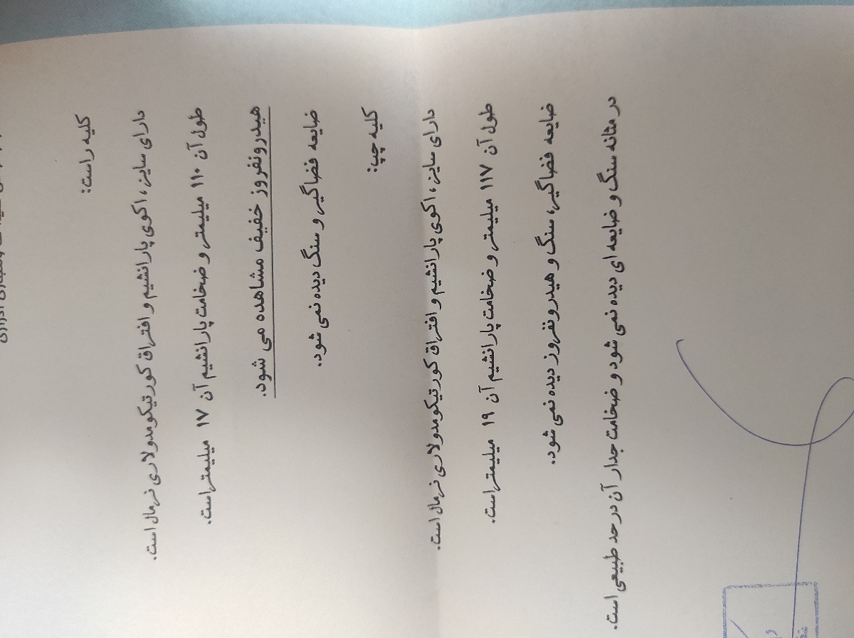 تفسیر سونوگرافی هفته ۲۸ بارداری تفسیر سونوگرافی هفته ۲۸ بارداری